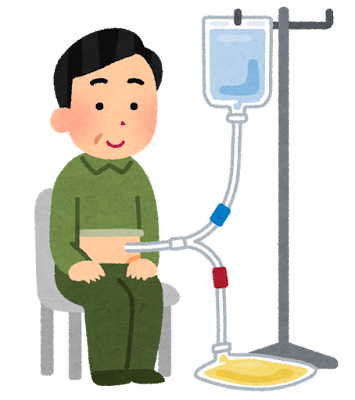 腹膜透析のイメージ図